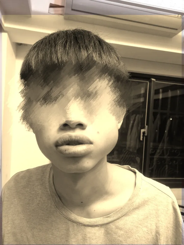 王姓同學被毆打到全身是傷，臉部腫震瘀青特別明顯，連牙齒都搖搖欲墜，已到醫院驗傷提告對方傷害罪。投訴人提供