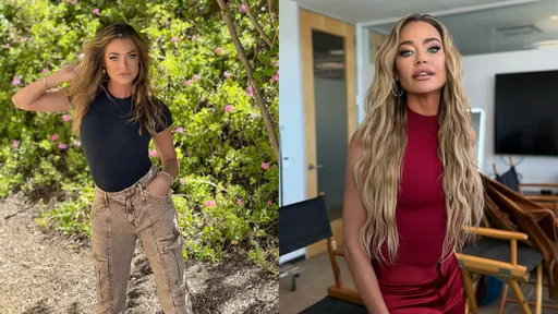 《007》龐德女郎錄生存節目「撞破奶」　重新手術得自費直言要命