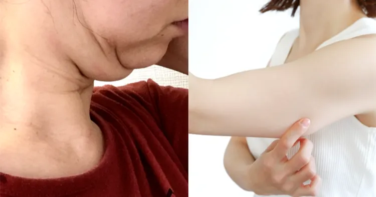 下巴輪廓線走樣、蝴蝶袖等，都是肌膚老化的現象，「Z音波」除了臉部，也能改善身體的各種鬆弛問題。