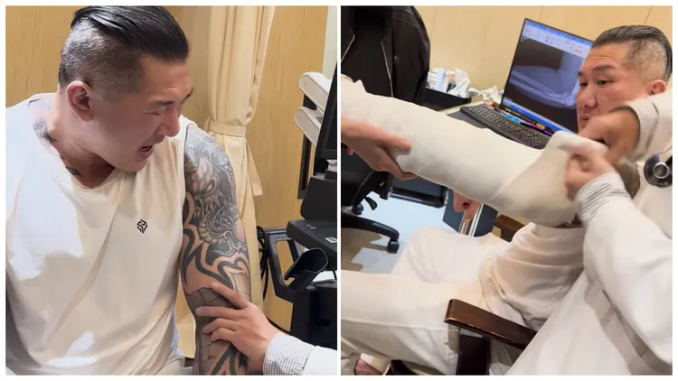 館長手臂打石膏。翻攝館張臉書