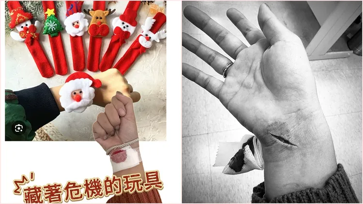 莎啦秀出長長傷口，警告這款玩具要特別小心。翻攝自莎拉是個四寶媽臉書粉專