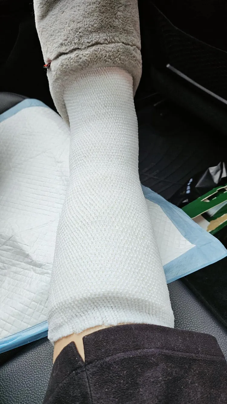 陳美鳳因走路滑手機，竟當場絆倒拐到腳！翻攝陳美鳳 MeiFen粉專