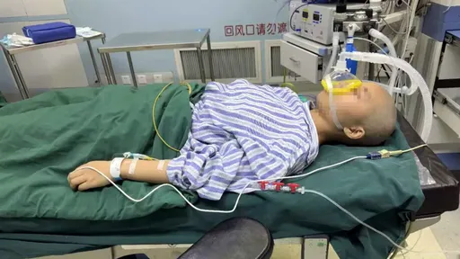 22歲女兒割全部頭皮救燒傷父 「生我養我用全身的皮我也願意」