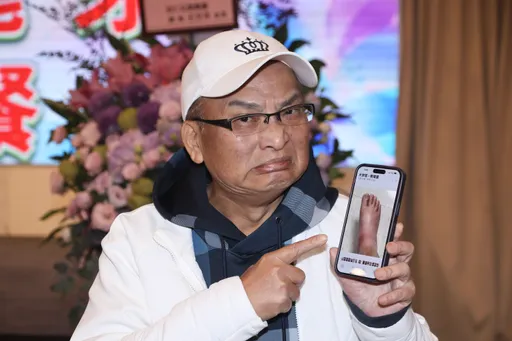 66歲孔鏘「腳發炎腫如豬腳」 查不出病因最怕1事