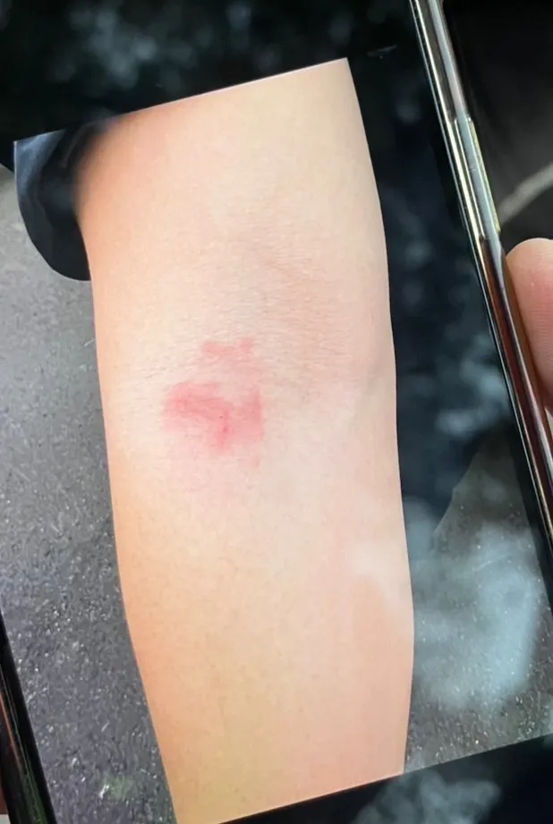 雷姓憲兵遭咬傷。警方提供