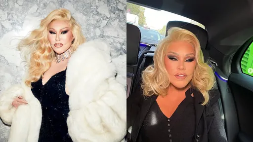 整形失敗整成貓臉 瑞士富婆過世享壽84歲