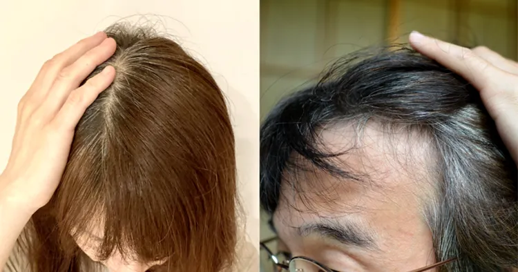 無論是男女，只要一有白髮就會讓人看起來特別顯老。