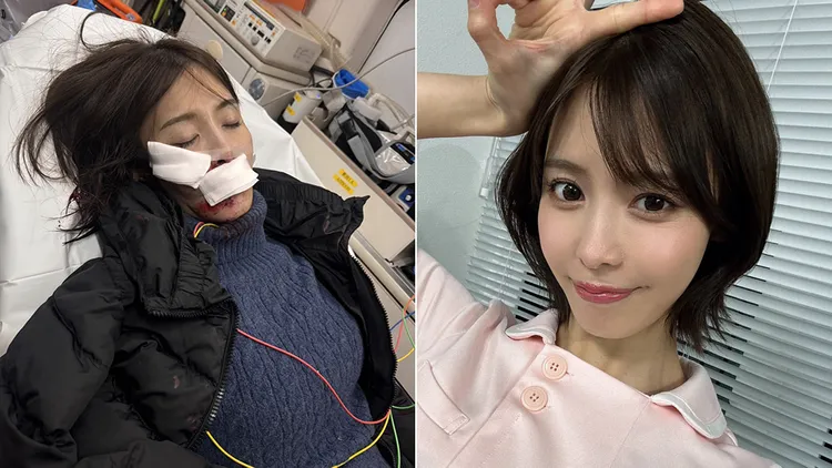 及川海公布受傷照片，揭露自己減少發文的原因。翻攝自及川海X