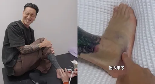 王陽明韌帶撕裂、2處骨裂　澳洲返台治療！痛到飆髒話