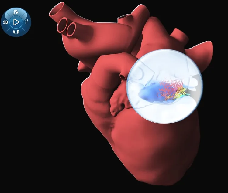 透過虛擬雙生技術，可以協助醫生更精準的了解如何為患者提供幫助。達梭提供