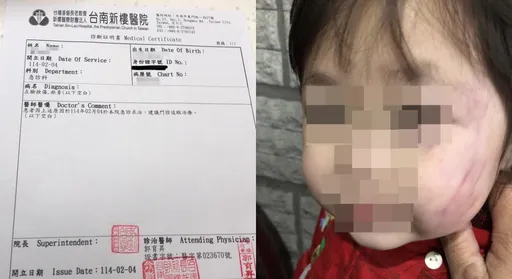 台南1歲多女童疑遭虐 補習班哀求「別驗傷會完蛋」!一查是這原因