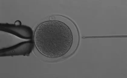 昆士蘭大學透過體外受精（IVF）技術，培育出全球首個袋鼠胚胎。取自昆士蘭大學網站
