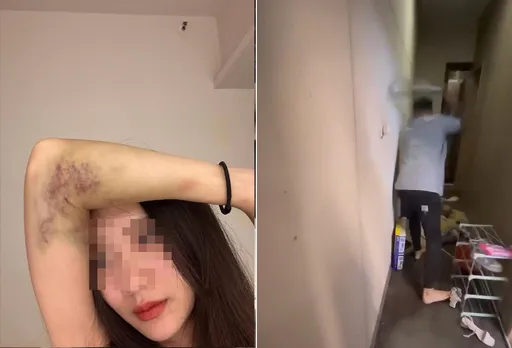 暴打女员工挨告杀人未遂 彰化「直播男神」反控她拉K还恐吓300万