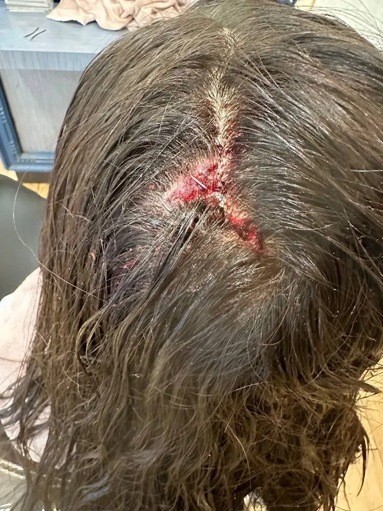 女員工頭部被打傷。民眾提供