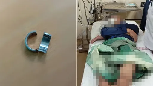 少年「GG只有手指粗」被消防局公告 下體戴戒指慘變警告範本