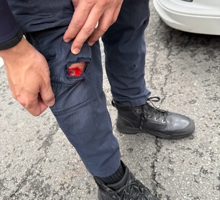 警員追捕過程中手腳擦挫傷。民眾提供