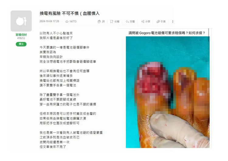 過去也曾發生多起電池握把斷裂砸傷使用者的案例。翻攝《Mobile01》、讀者提供