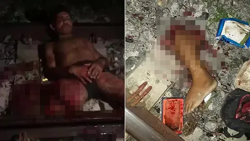 他竟在鐵軌上睡著了 被火車輾斷雙腿命危