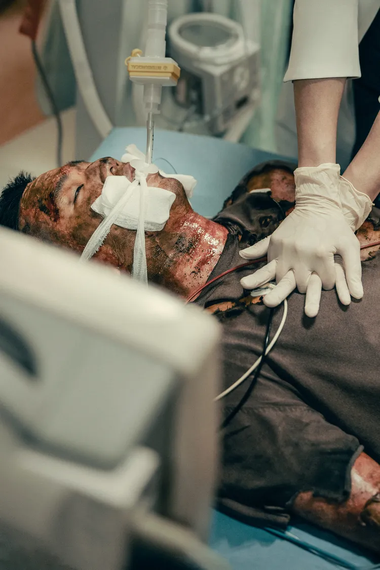 影集中塵暴燒燙傷病患的特效化妝相當逼真。公視、中華電信、瀚草文創提供