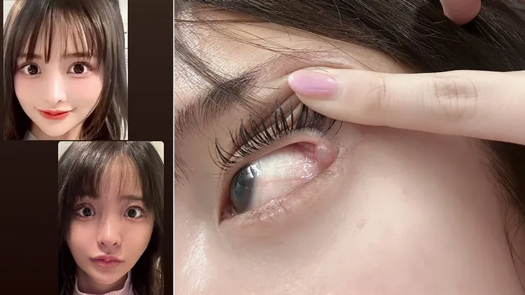 白濱希自曝整型失敗。翻攝自白濱希X