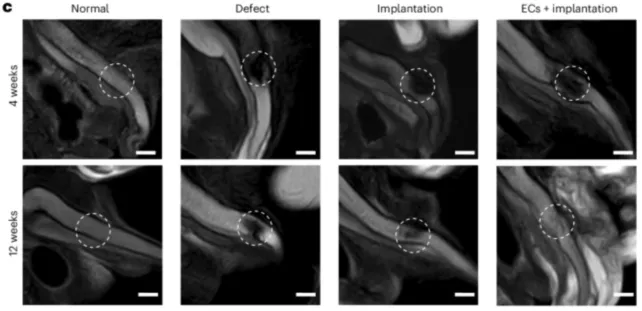 兔陰莖受損處(白色圈)接受3D列印植入後逐漸恢復正常功能。Science Alert