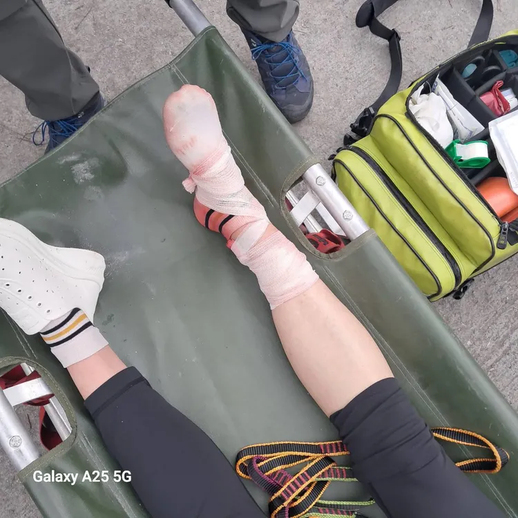 登山客遭落石砸傷。翻攝畫面