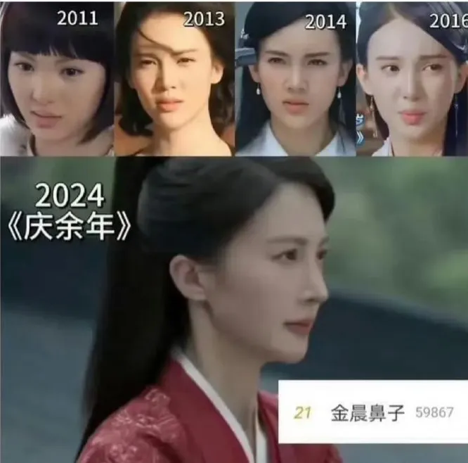 娛樂博主整理出她這些年的鼻子變化照。翻攝常春藤姥姥微博