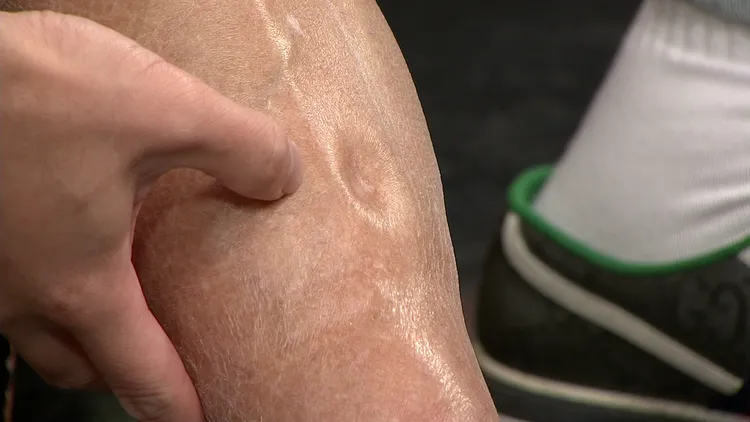 孔鏘坦言右腳不明腫脹2個月，非常擔心若被截肢就無法再彈琴了。年代提供