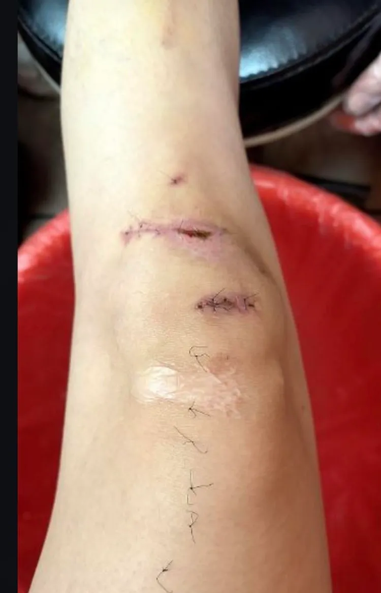 陳女胞弟Allen 9日近日發出姊姊遭傷害照片，希望能替姊姊伸冤。翻攝畫面