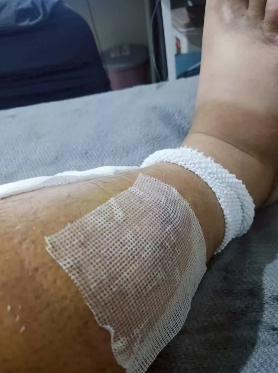 騎士摔傷送醫。徐立信提供