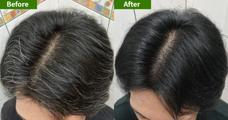 使用前灰白髮讓人看起來顯老沒精神，使用後立刻遮白，髮色均勻整個人年輕起來。