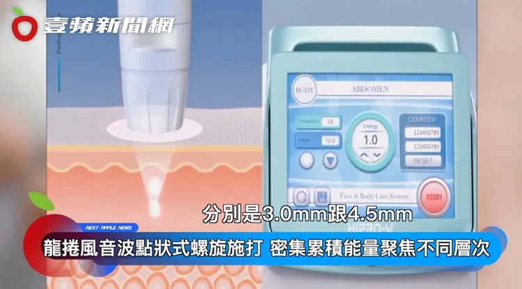 龍捲風無限音波範圍涵蓋真皮層、下真皮層及SMAS筋膜層，突破許多雷射深度限制。