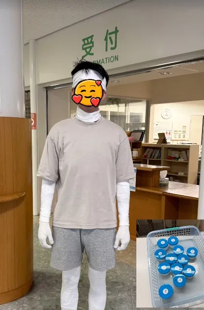 阿滴塗完藥膏後，全身包紮起來。翻攝阿滴IG