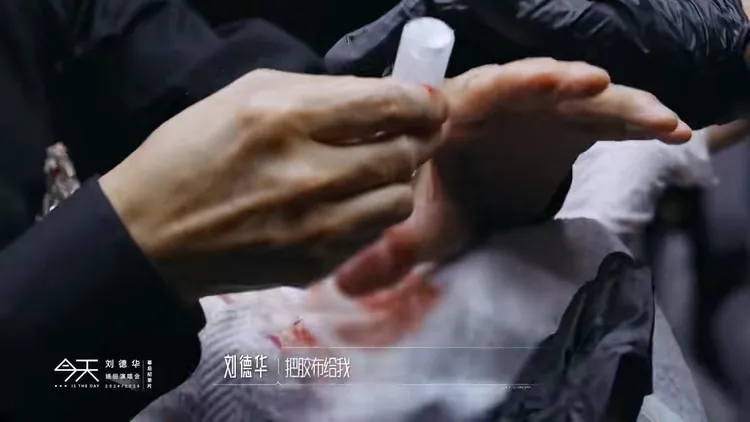 劉德華到後台緊急處理左手大拇指傷口。翻攝劉德華抖音