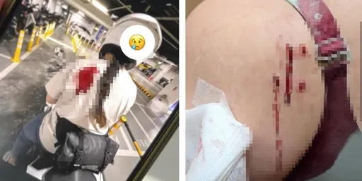 信義區101喋血!27歲女遭人「瑞士刀猛刺」 憂「如果今天在商場...」