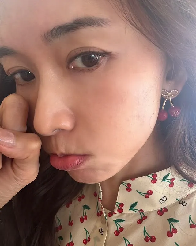 林志玲哭哭臉部過敏起紅疹。翻攝林志玲IG