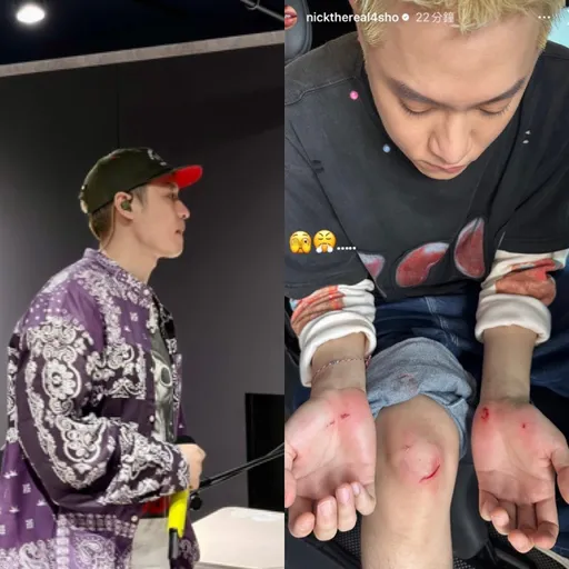 男神周湯豪怎麼又傷了 驚人傷勢曝光!手腳都是血