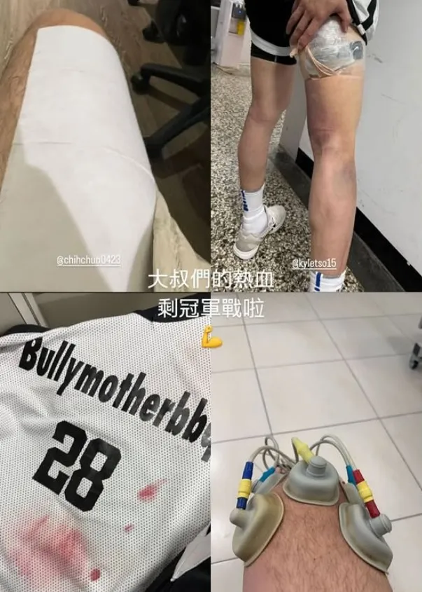 大家都帶傷硬拼。翻攝王陽明IG