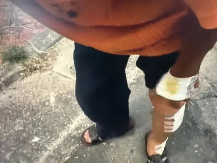 受傷騎士迄今還未完全痊癒，警方追7天陳男才到案說明。翻攝照片