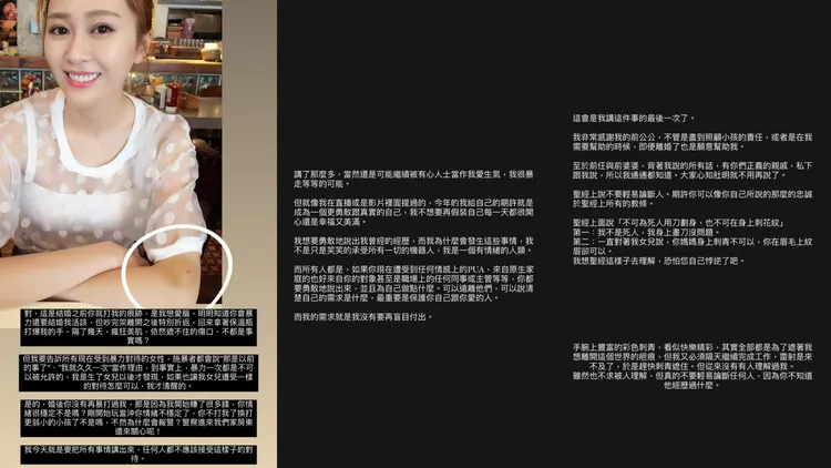 「分手妹」陳佩佩踢爆前夫拿鐵種種暴力惡行。翻攝《@arialchenpeipei》IG