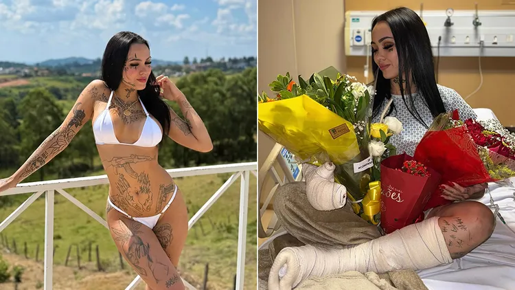 露娜手術後po出照片（右圖）報平安。翻攝自露娜IG