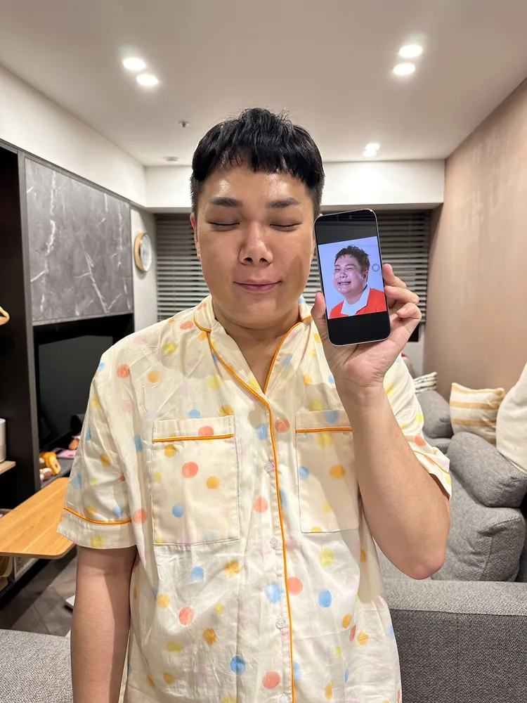 關韶文曬出曬出自己兩年前手術後的對比。翻攝關韶文臉書