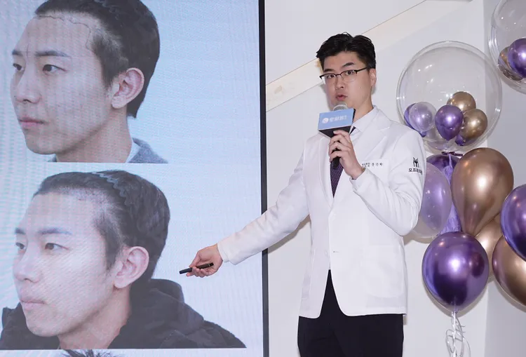 MOPRO CLINIC院長文建學醫師分享植髮經歷。彭欣偉攝