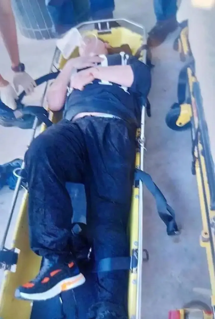 姜濤手臂有傷痕。翻攝趙啊啊小姐姐小紅書