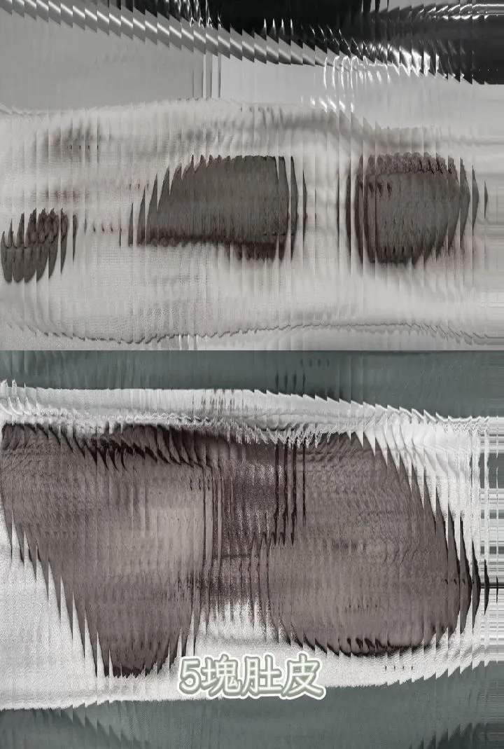 李宓做腹部拉皮手術和修疤手術切下2大塊、3小塊肚皮。翻攝李宓臉書