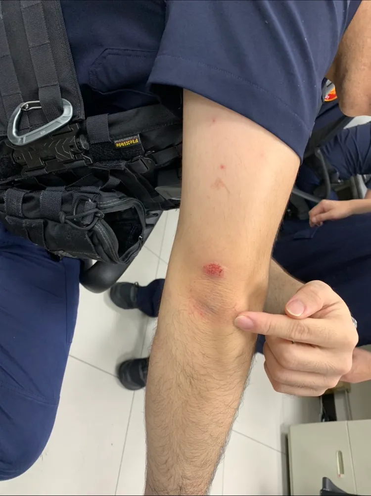 員警壓制過程中負傷。警方提供
