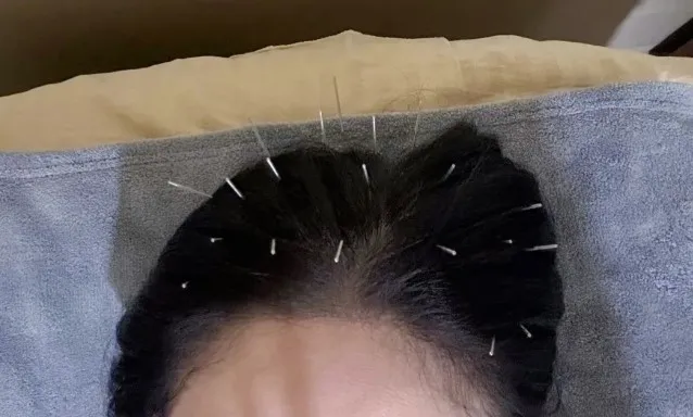 連頭頂都不放過。翻攝陳喬恩小紅書