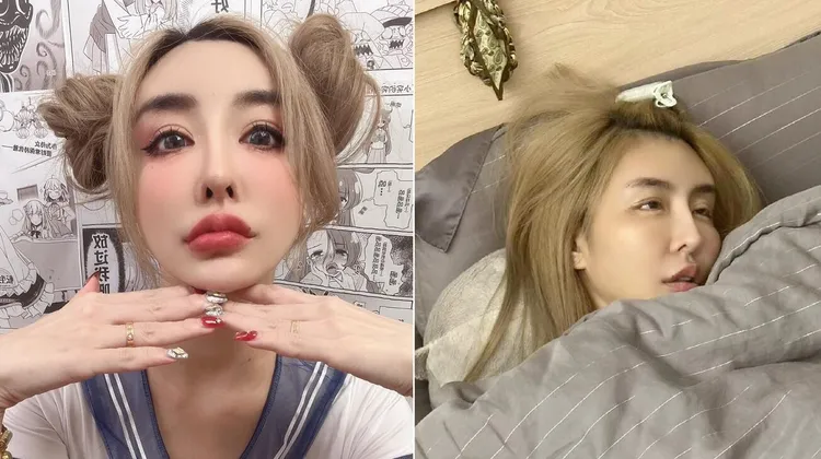 「情色教主」雪碧整過頭，睡覺曾經眼皮閉不起來。翻攝雪碧臉書