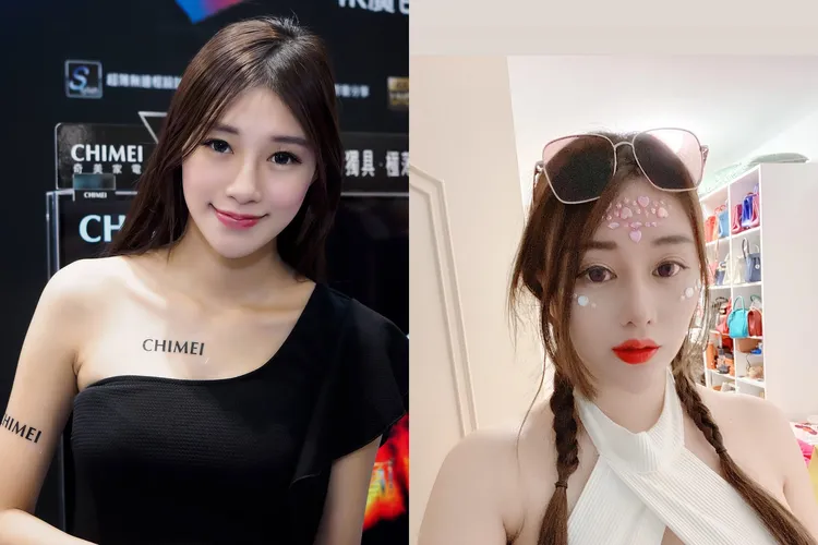 「車模界林志玲」前往名醫吳紹琥的醫美診所打牛奶針命危。翻攝自蔡語芯（泡泡）臉書