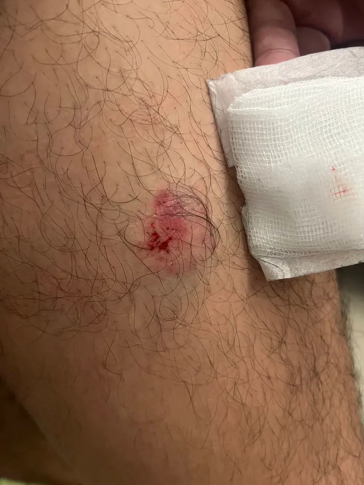 左營派出所員警被咬傷。翻攝畫面